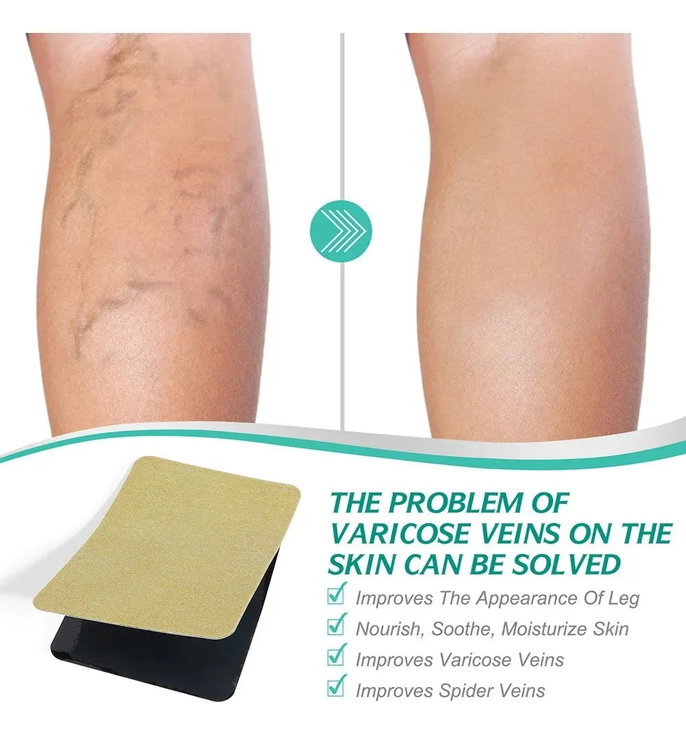 Parches para Piernas con Venas Varicosas