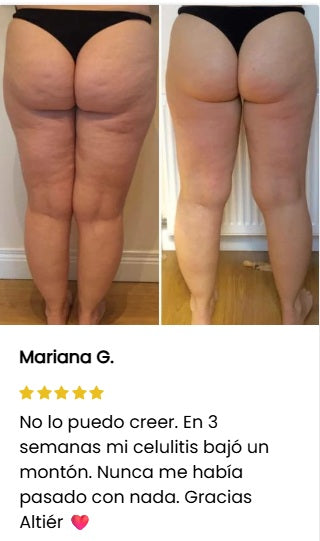 AntiCelulitis, AntiEstrías y Reafirmante de piel - Aceite con Extracto de Plantas Naturales