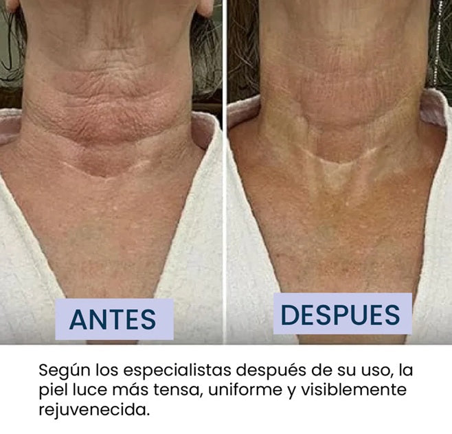 Crema Antiarrugas Cuello y Escote