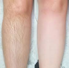 Crema Depiladora Corporal con Aloe Vera y Vitamina E
