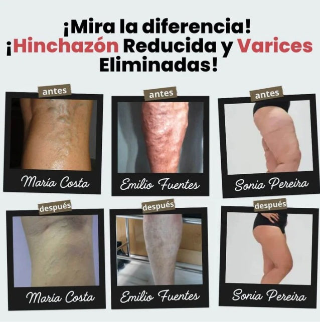 2x1 en calcetines de acupresión antivárices