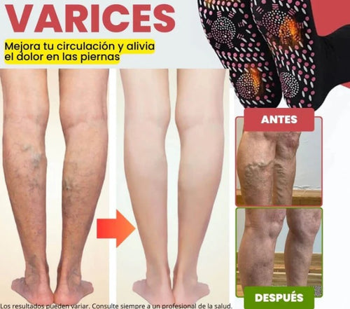 2x1 en calcetines de acupresión antivárices