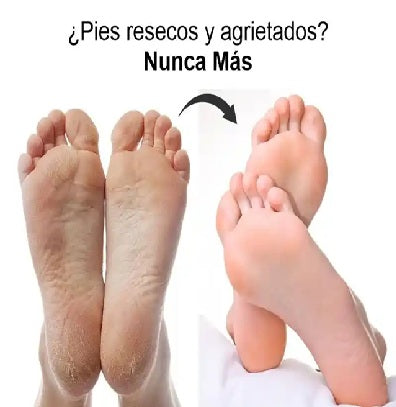 "Crema Humectante Urea 40% | Hidratación y Regeneración Intensa para Piel Seca"