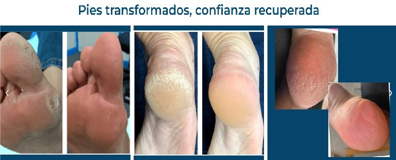 Crema para pies / Hidratación y Regeneración Intensa para Piel Seca