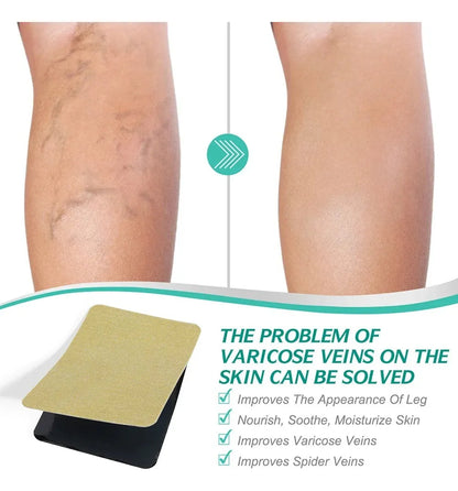 Parches para Piernas con Venas Varicosas
