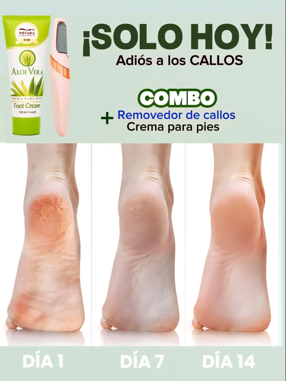 Removedor de Callos + Crema para pies agrietados (CALLOS)