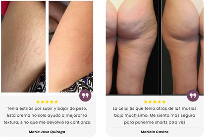 AntiCelulitis, AntiEstrías y Reafirmante de piel - Aceite con Extracto de Plantas Naturales