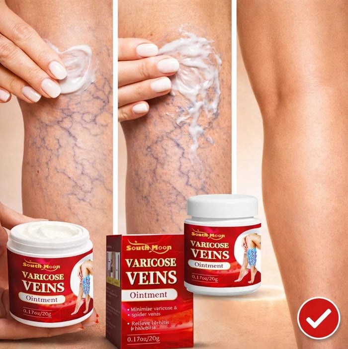 varicose veins crema para várices