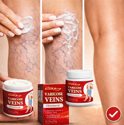 varicose veins crema para várices