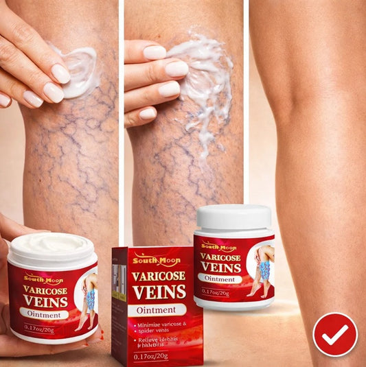 varicose veins crema para várices
