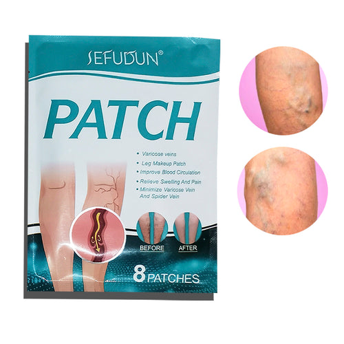 Parches para Piernas con Venas Varicosas